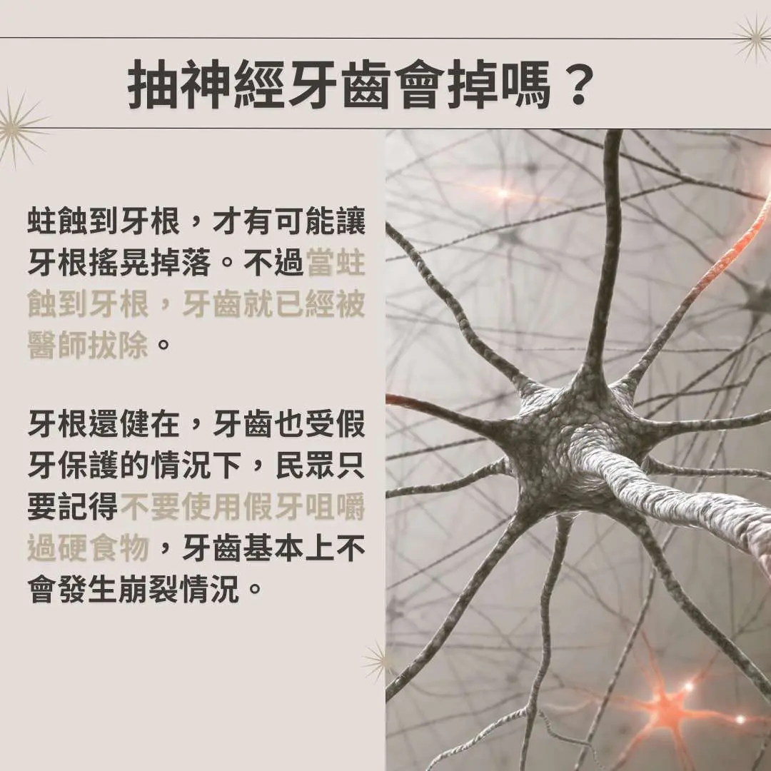 牙齒抽神經缺點會很多嗎?到底應不應該抽神經? 2 抽神經牙齒會掉嗎