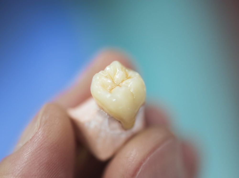 Read more about the article 植牙牙冠的功用是什麼？植牙全瓷冠差別會不會很大？