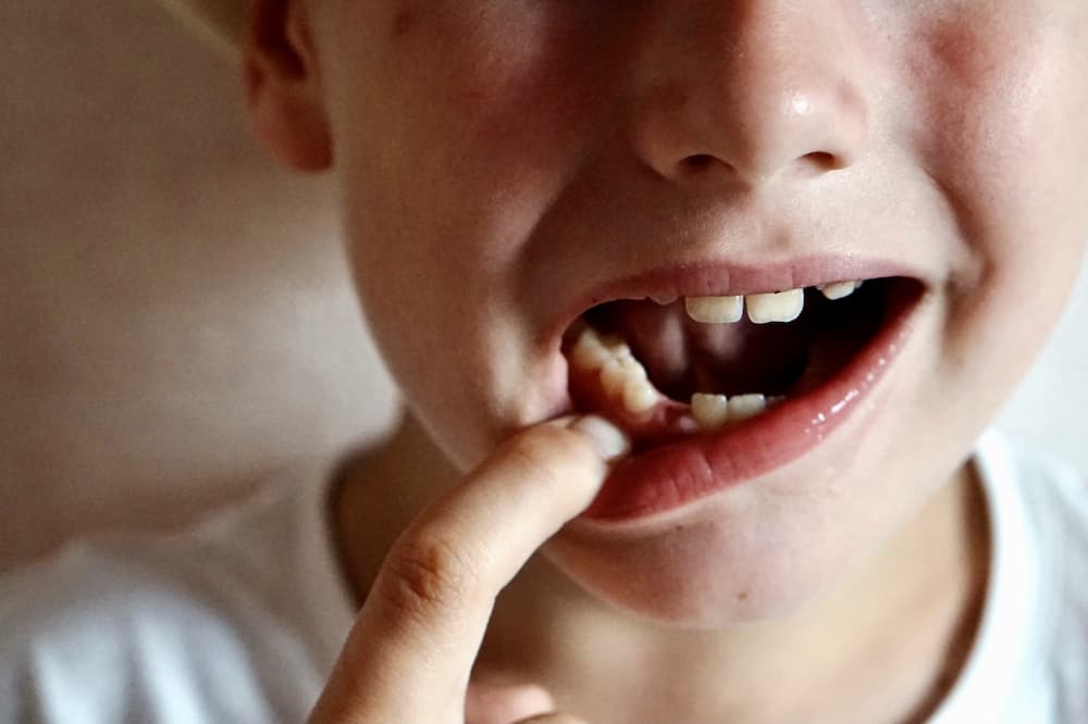 兒童牙齒抽神經跟成人有什麼不同？