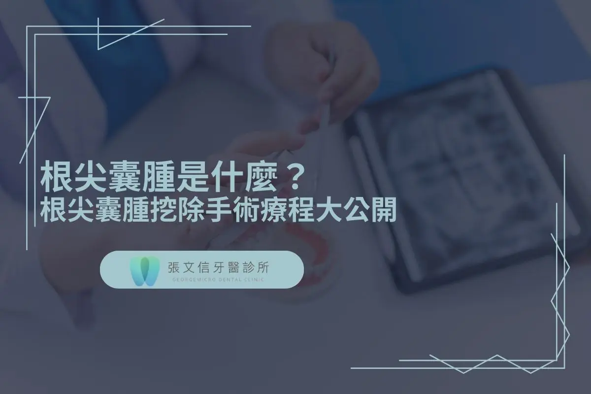 根尖囊腫是什麼？根尖囊腫挖除手術療程大公開