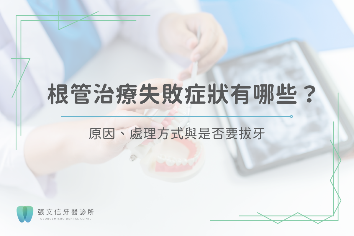 Read more about the article 根管治療失敗症狀有哪些？原因、處理方式與是否要拔牙
