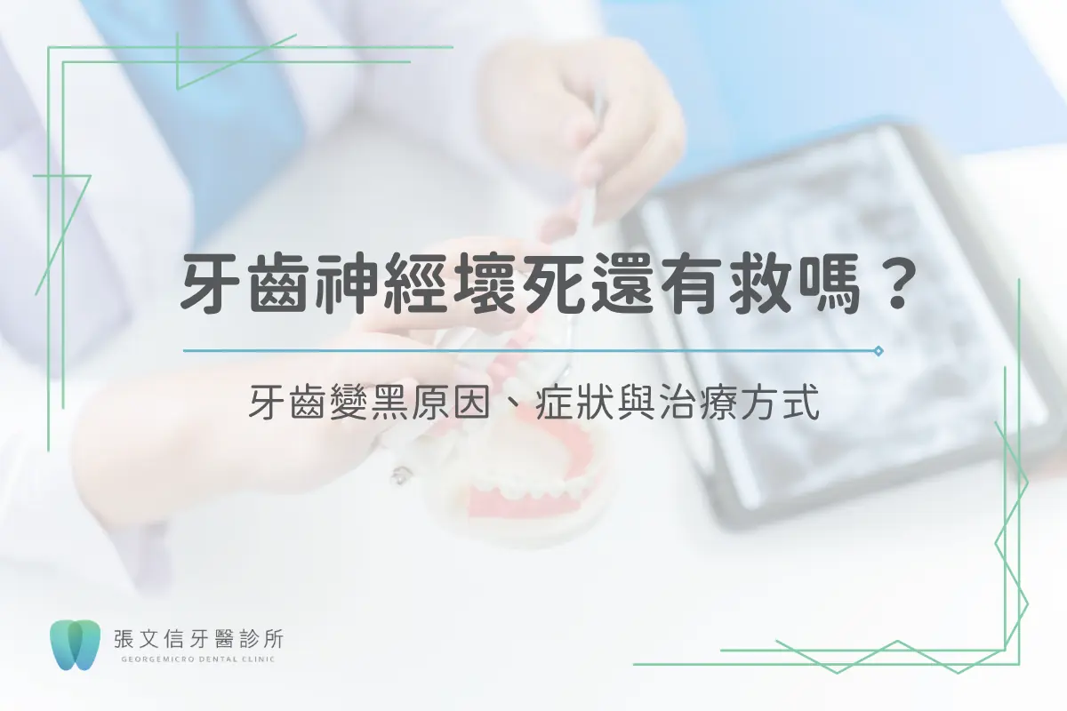 Read more about the article 牙齒神經壞死還有救嗎？牙齒變黑原因、症狀與治療方式