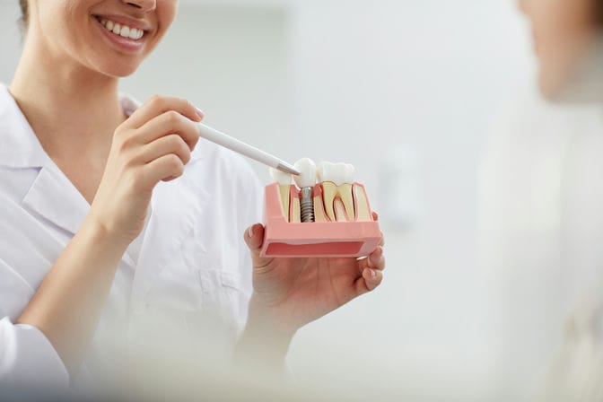 smiling dentist explaining tooth implantation 2021 09 24 03 53 51 utc
