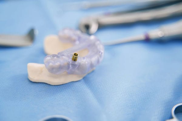 teeth model with metal implant in dental clinic 2022 03 31 17 41 39 utc