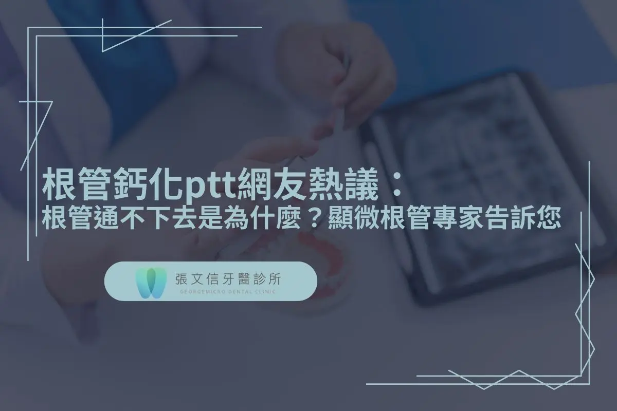 根管鈣化ptt網友熱議：根管通不下去是為什麼？顯微根管專家告訴您
