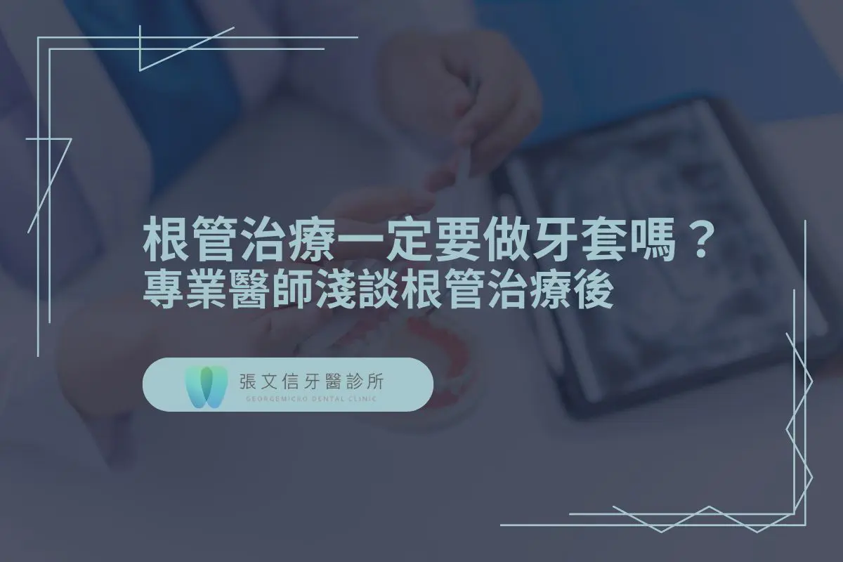 根管治療一定要做牙套嗎？專業醫師淺談根管治療後