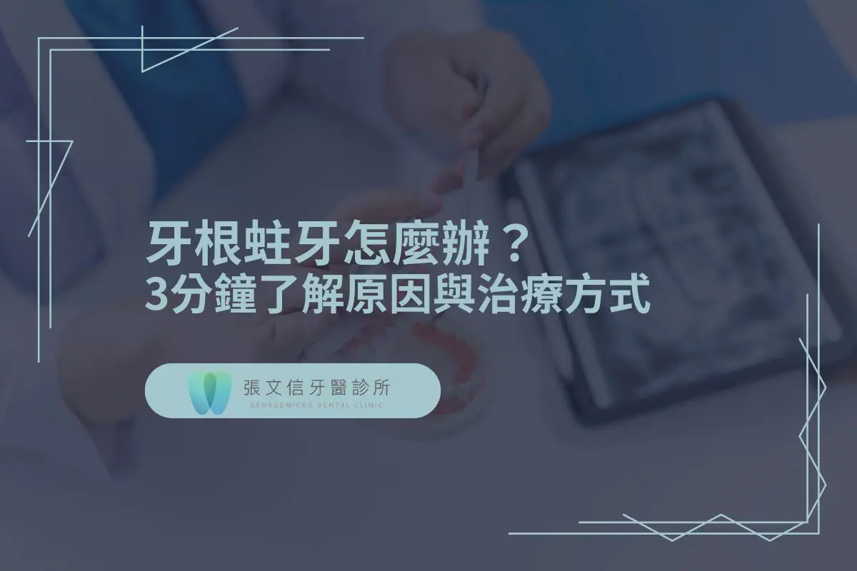 最新消息 1 牙根蛀牙怎麼辦?3分鐘了解原因與治療方式