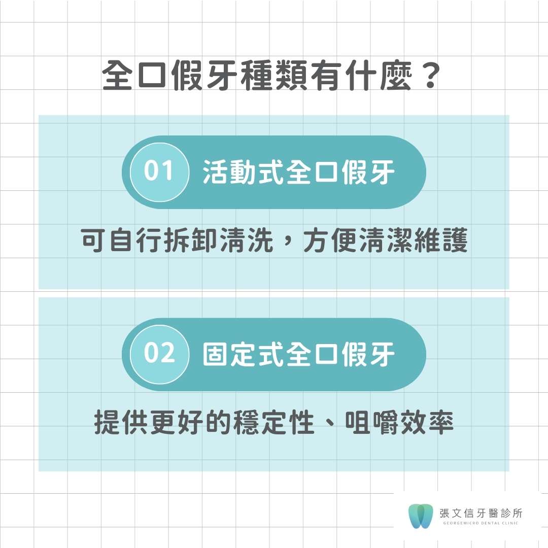 全口假牙種類有什麼?