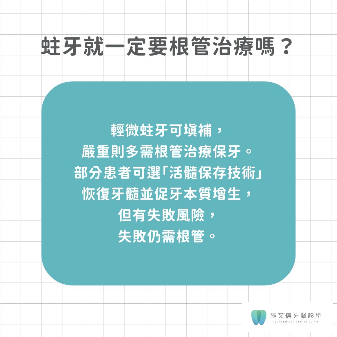 蛀牙一定要做根管治療嗎?根管治療目的大公開 2 蛀牙就一定要根管治療嗎?