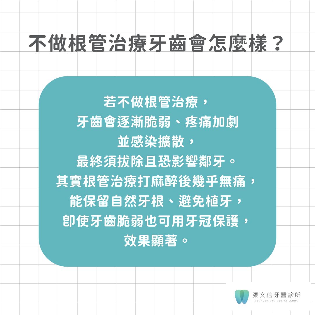 蛀牙一定要做根管治療嗎?根管治療目的大公開 3 如果不根管治療,牙齒會怎麼樣
