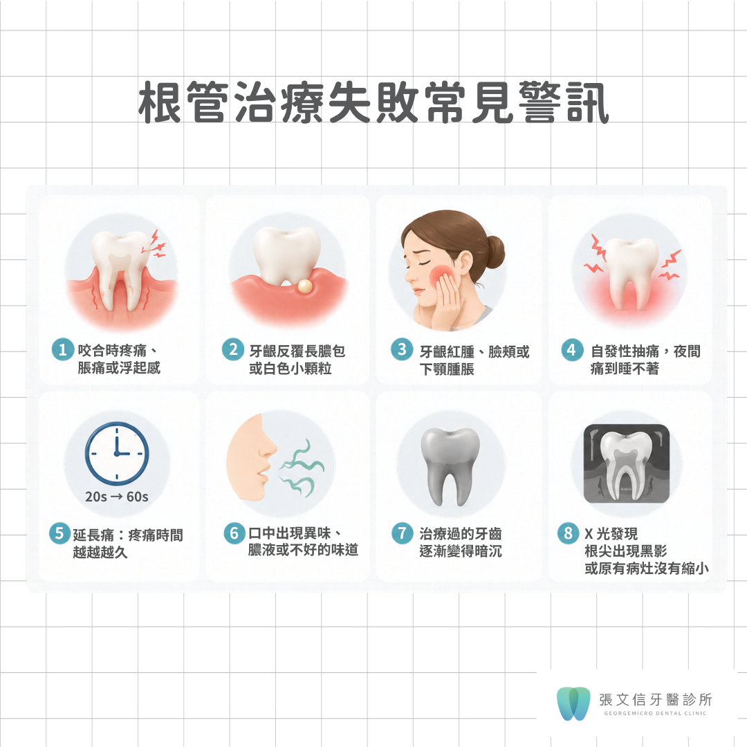 根管治療失敗症狀有哪些?原因、處理方式與是否要拔牙 1 根管治療失敗常見警訊8點