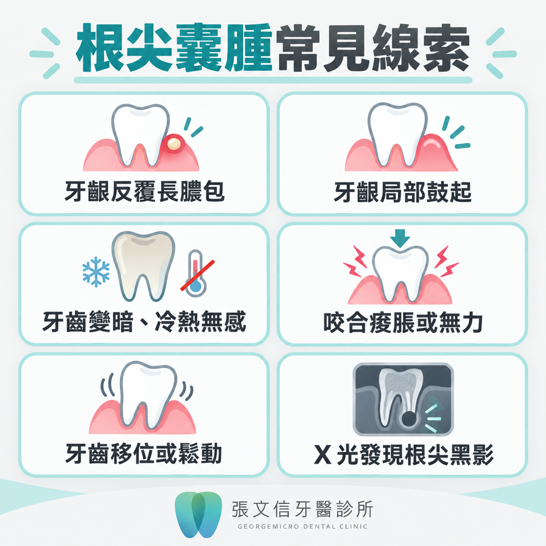 整理牙齦反覆長膿包、牙齒變暗、咬合痠脹、牙齒鬆動與根尖黑影等線索