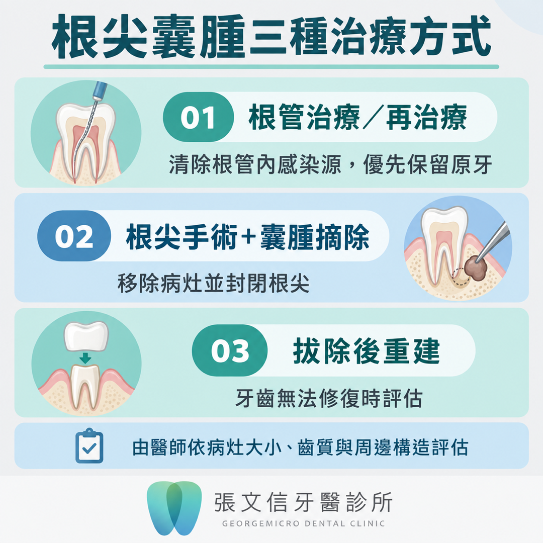 比較根管治療、根尖手術合併囊腫摘除，以及拔除後重建的適用方向